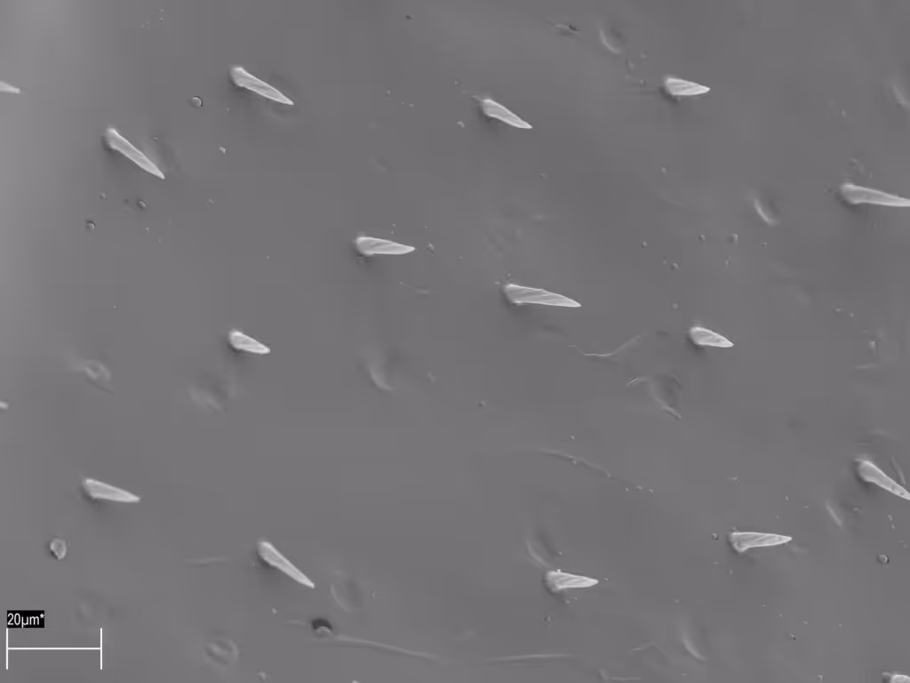 Ergot des ailes